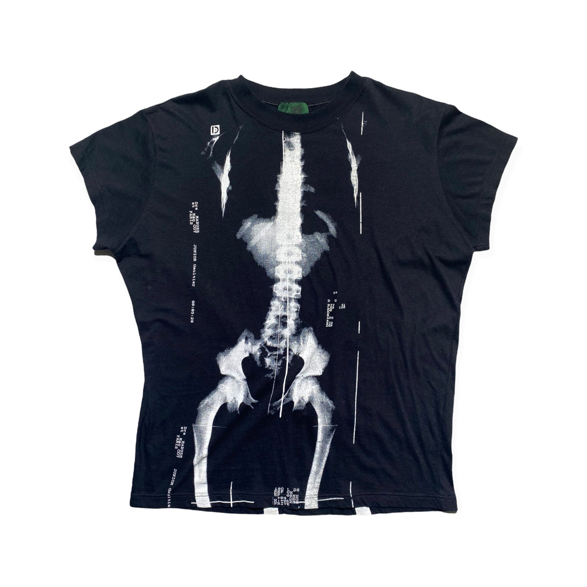 X-ray tee